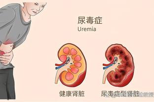 心系母校啊？马刺球迷：得克萨斯大学要输了 成功引起KD的注意